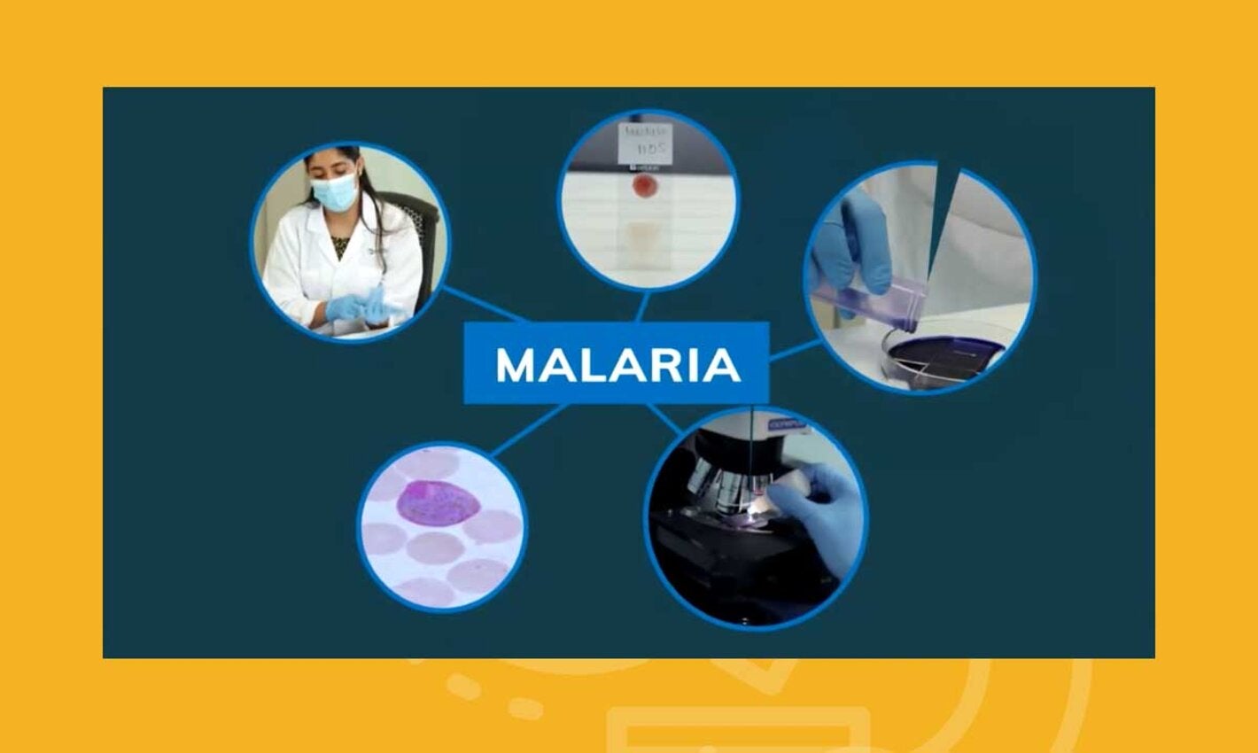 Lanzamiento de curso teórico de autoaprendizaje Diagnóstico Microscópico de la Malaria