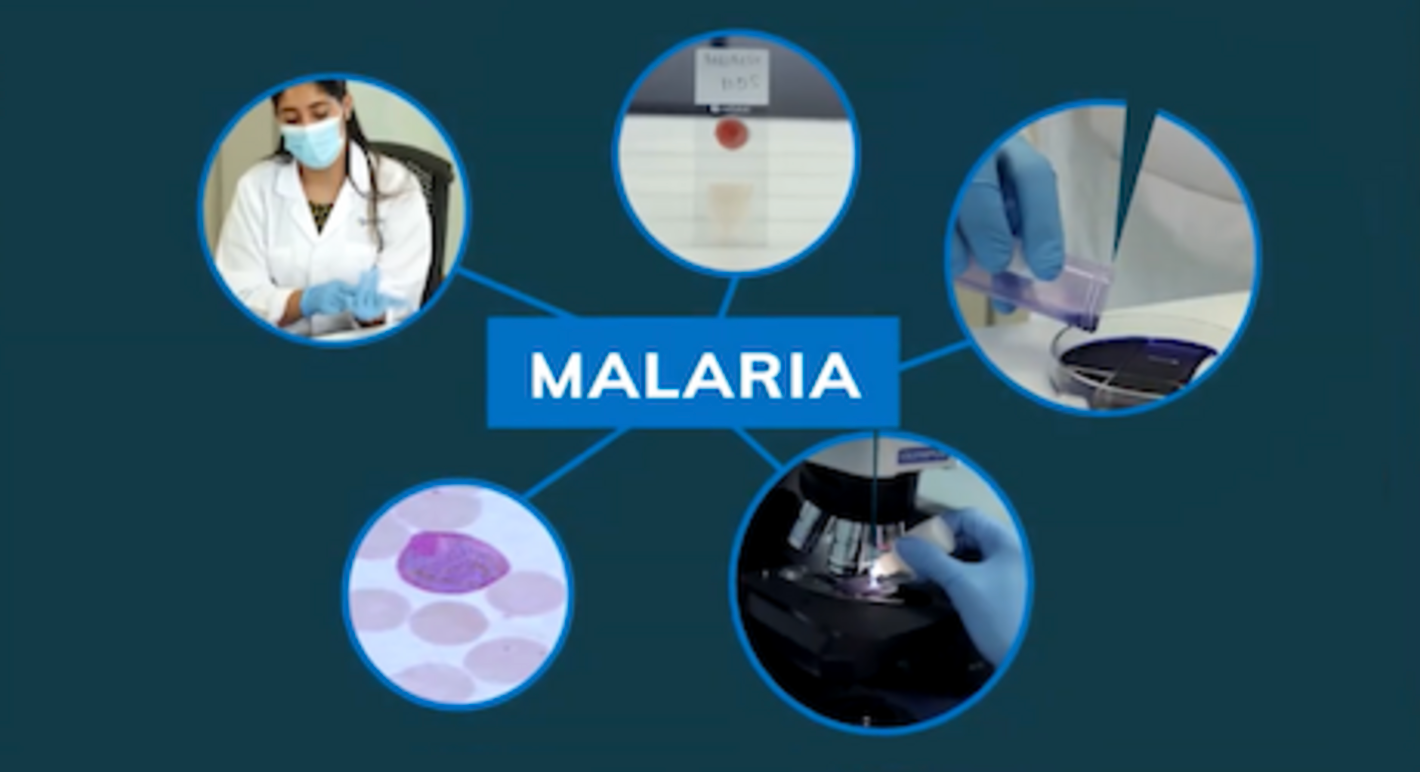 CursoVirtual_Malaria