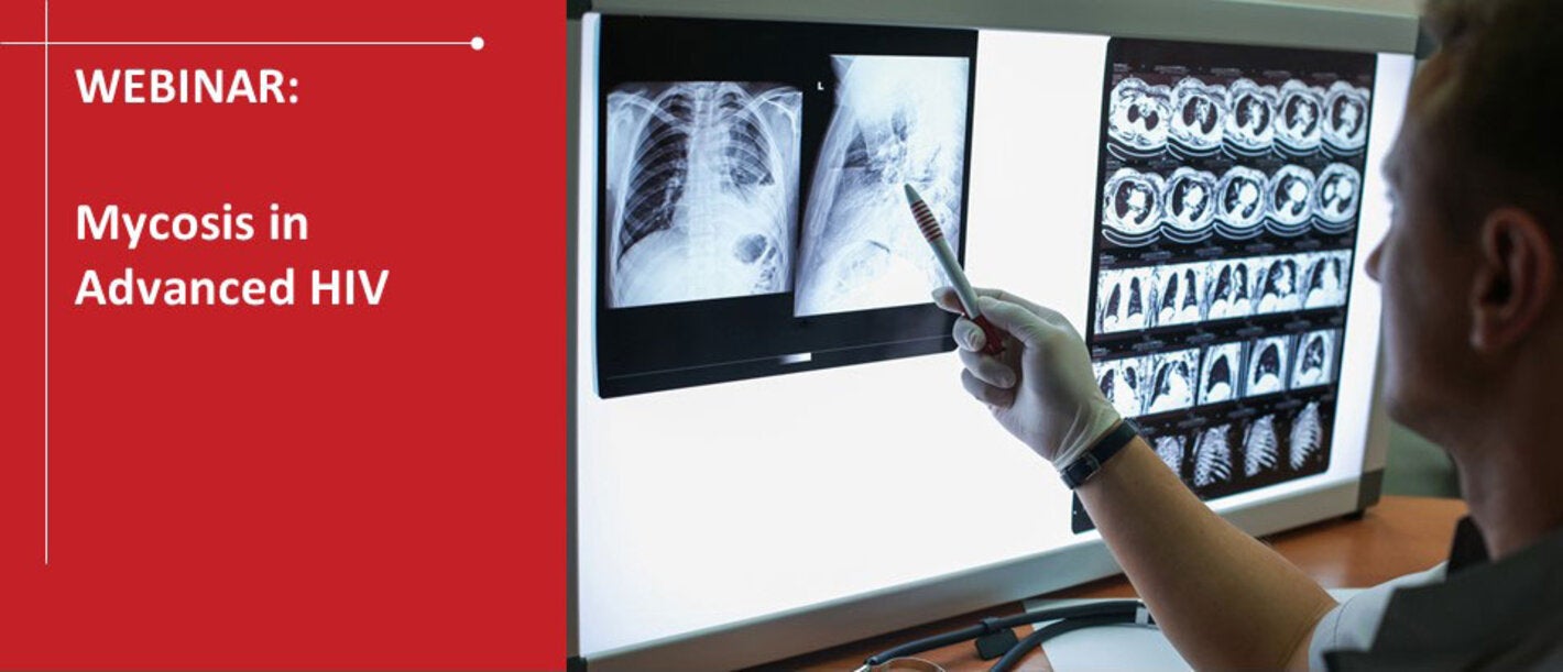 Mycosis in Advanced HIV 