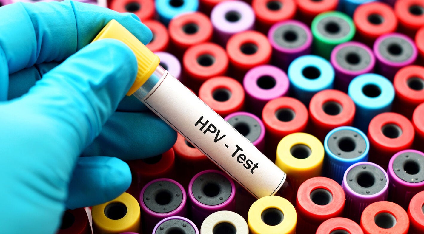 HPV testing