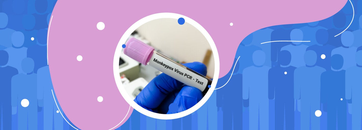 Webinar Viruela Símica y Reuniones Masivas