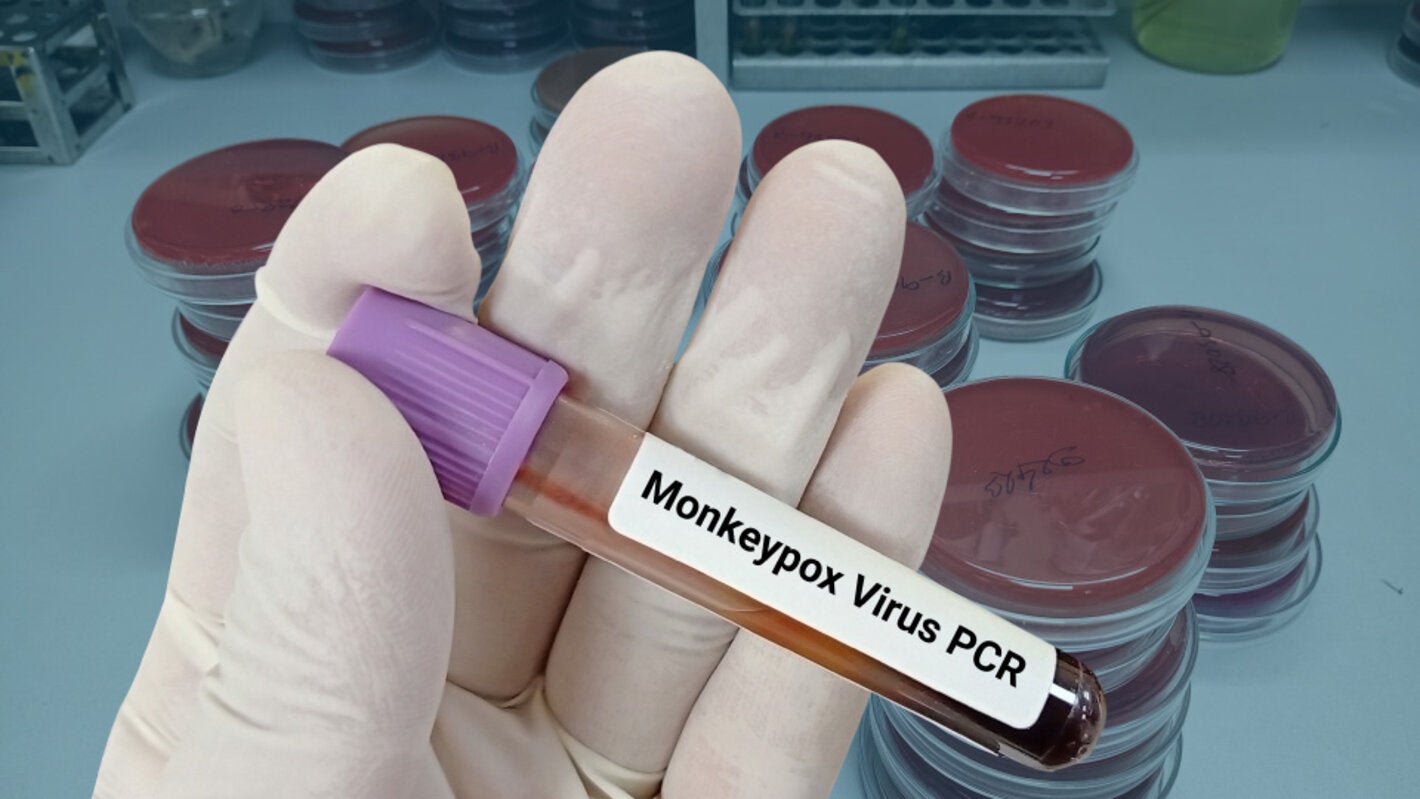 Viruela Símica, Actualización epidemiológica y manejo clínico