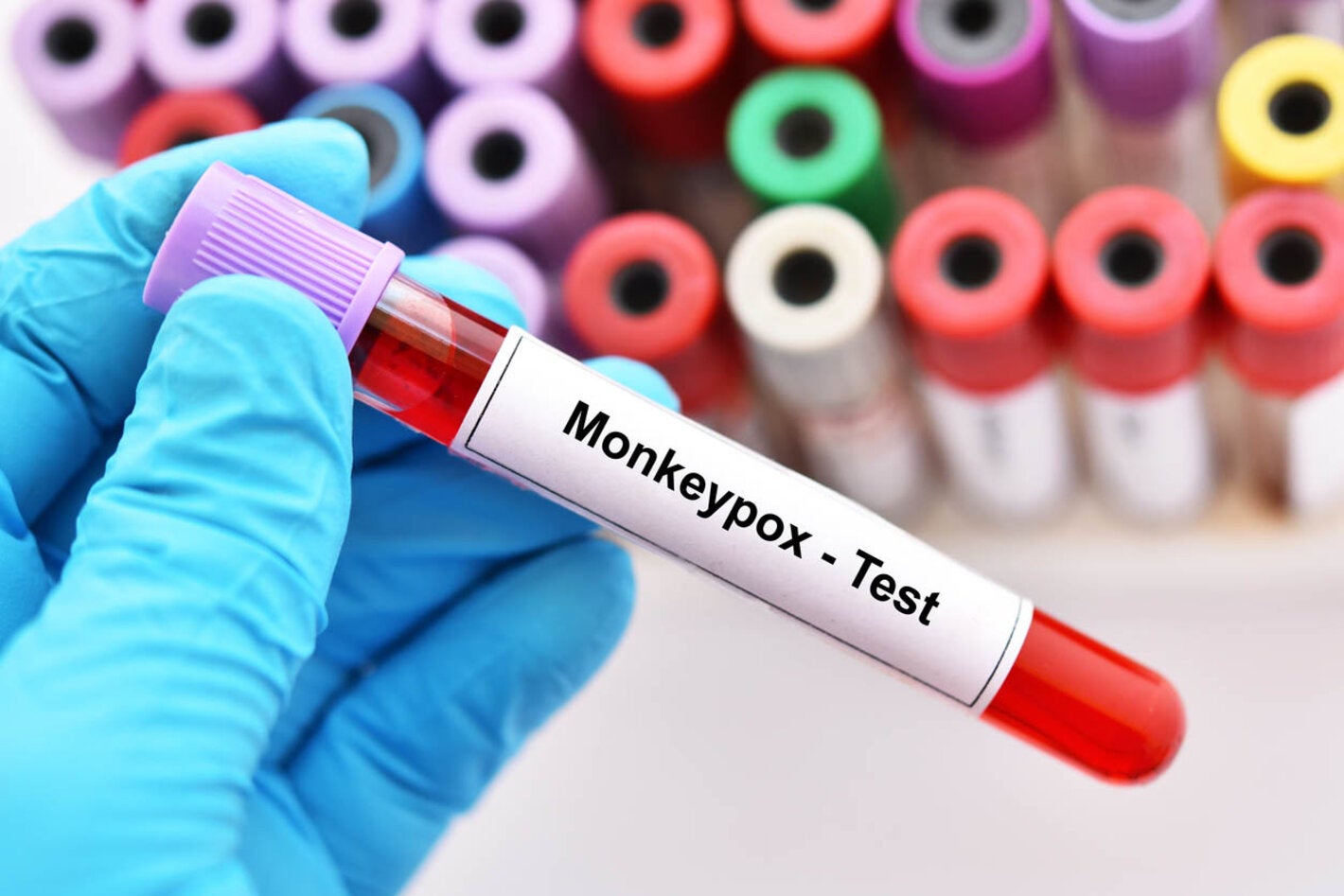 Testing for monkeypox at lab