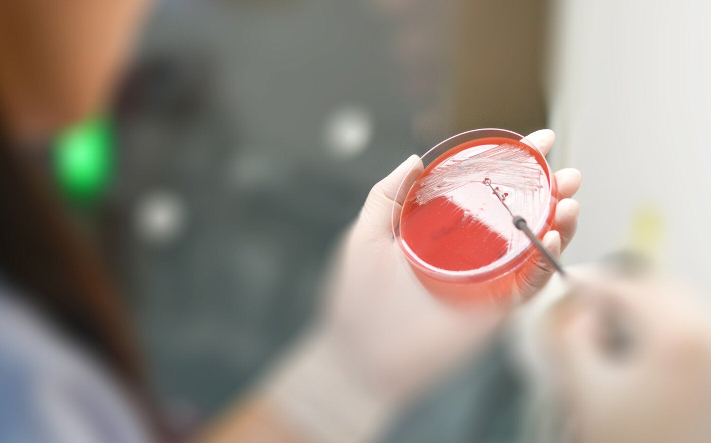 Testes de laboratório de patógenos resistentes