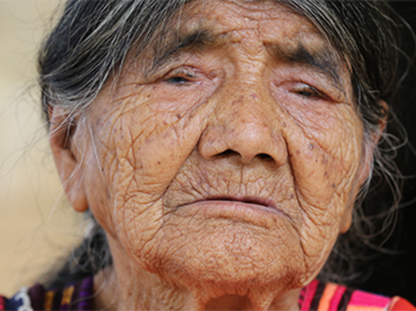 Cómo México eliminó el tracoma, la principal causa prevenible de ceguera