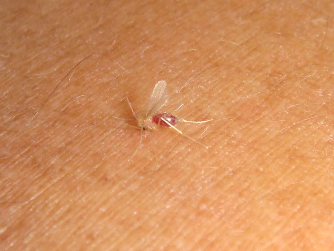mosquito leishmaniasis