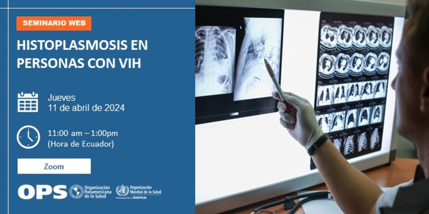 Webinario: Histoplasmosis en personas con VIH
