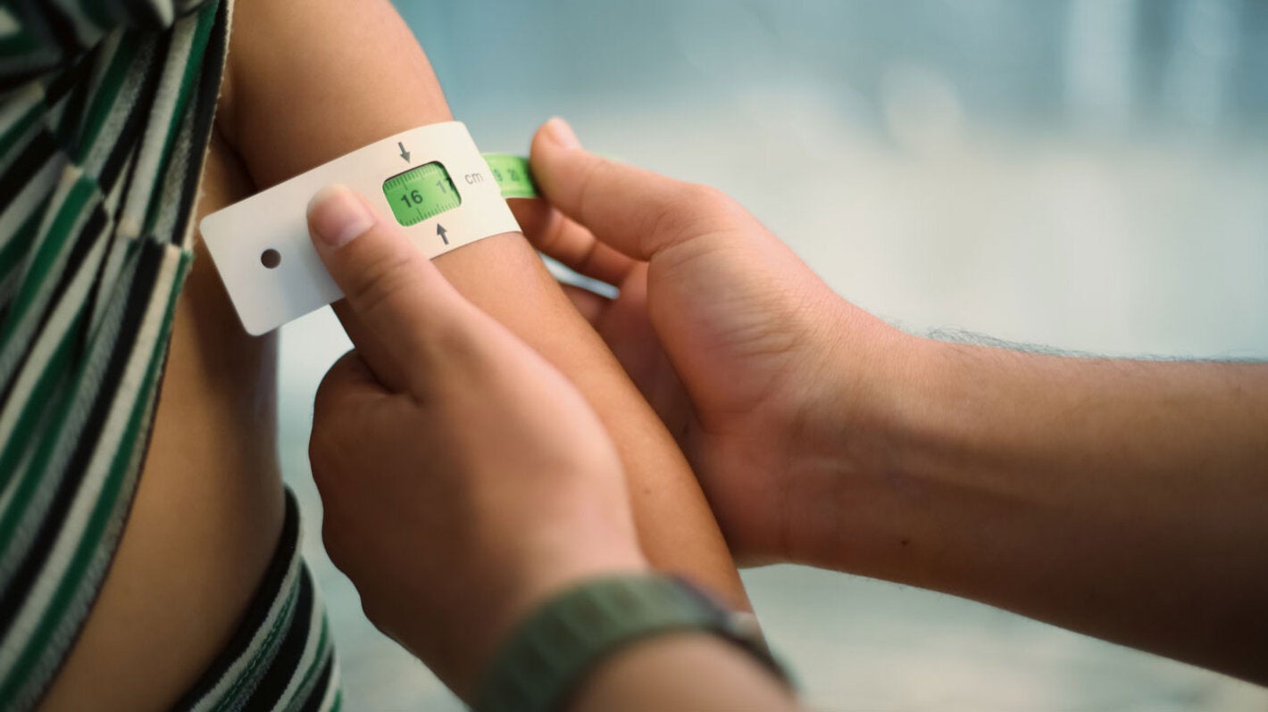 Measuring mid-upper-arm circumference