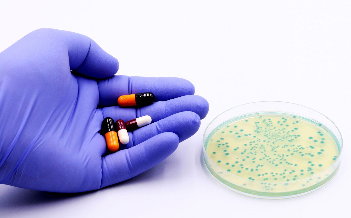 Bacteria in a Petri dish and in the hand of a doctor or researcher antibiotics or drugs.