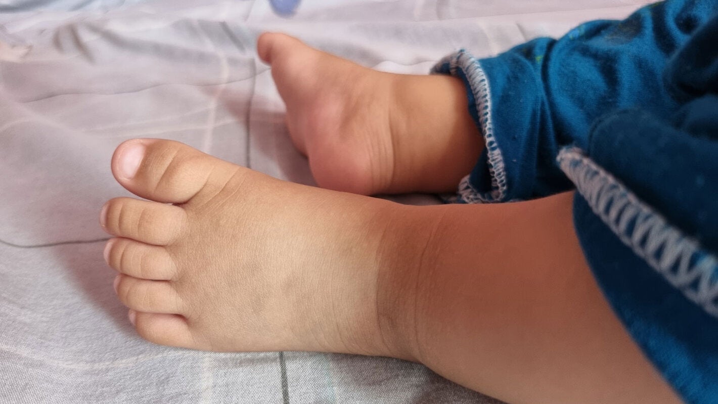 Babies feet