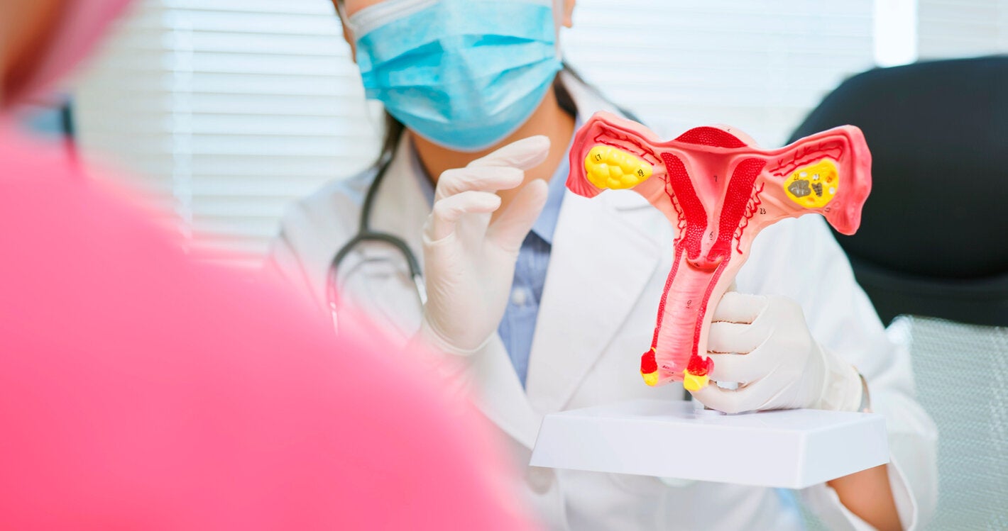 bra-cancer-colo-utero