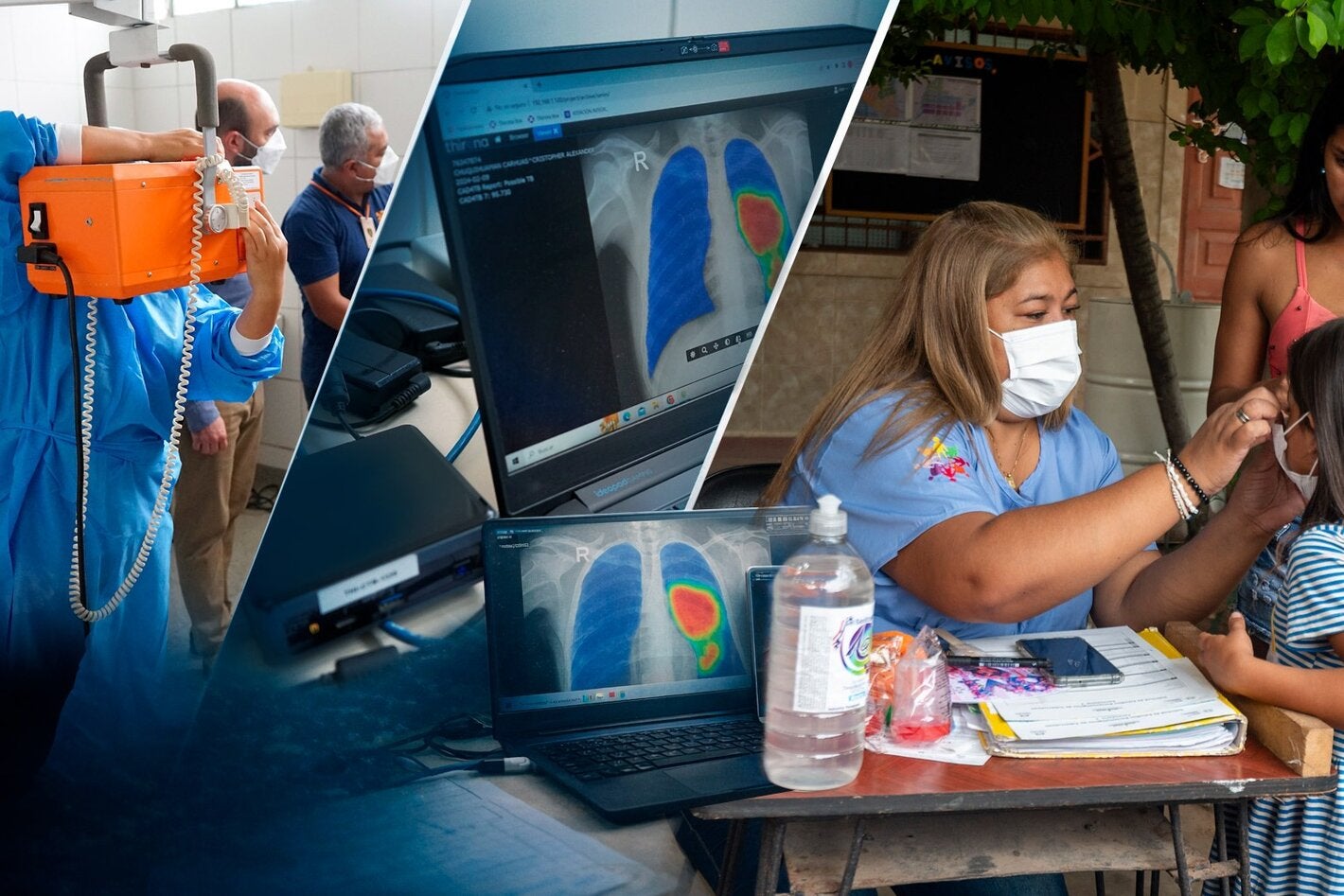 Podemos acabar com a tuberculose: apoiados por uma Atenção Primária à Saúde fortalecida pela inovação e pelo compromisso dos profissionais de saúde e das comunidades