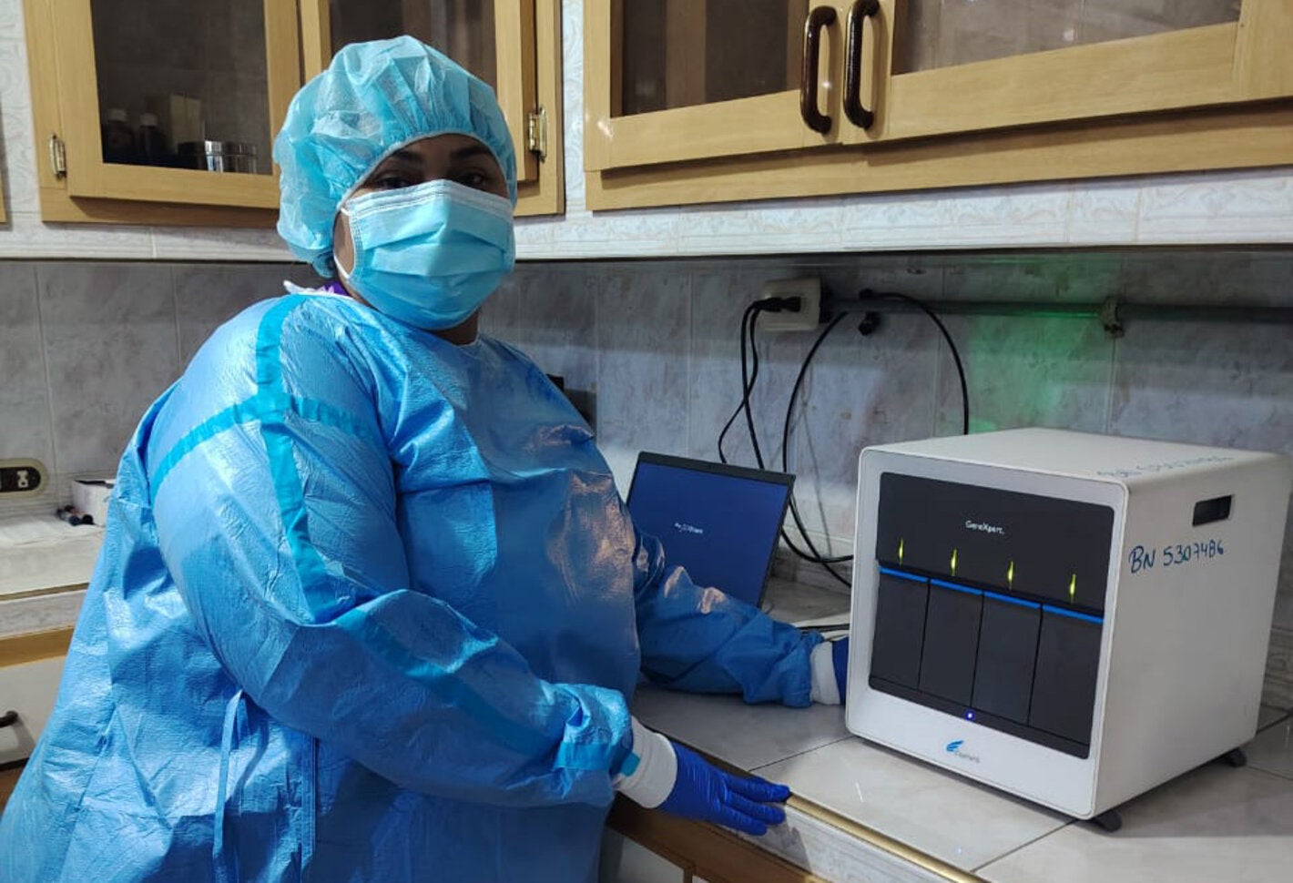 Equipo de GeneXpert en la dirección estadal de salud del estado Barinas