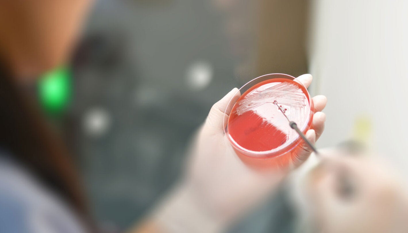 Lab technicians working on the media plate to culture and bacteria and drug resistance of pathogens in hospital laboratory