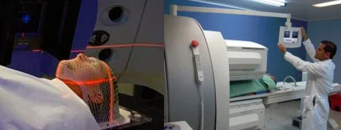 radiografía