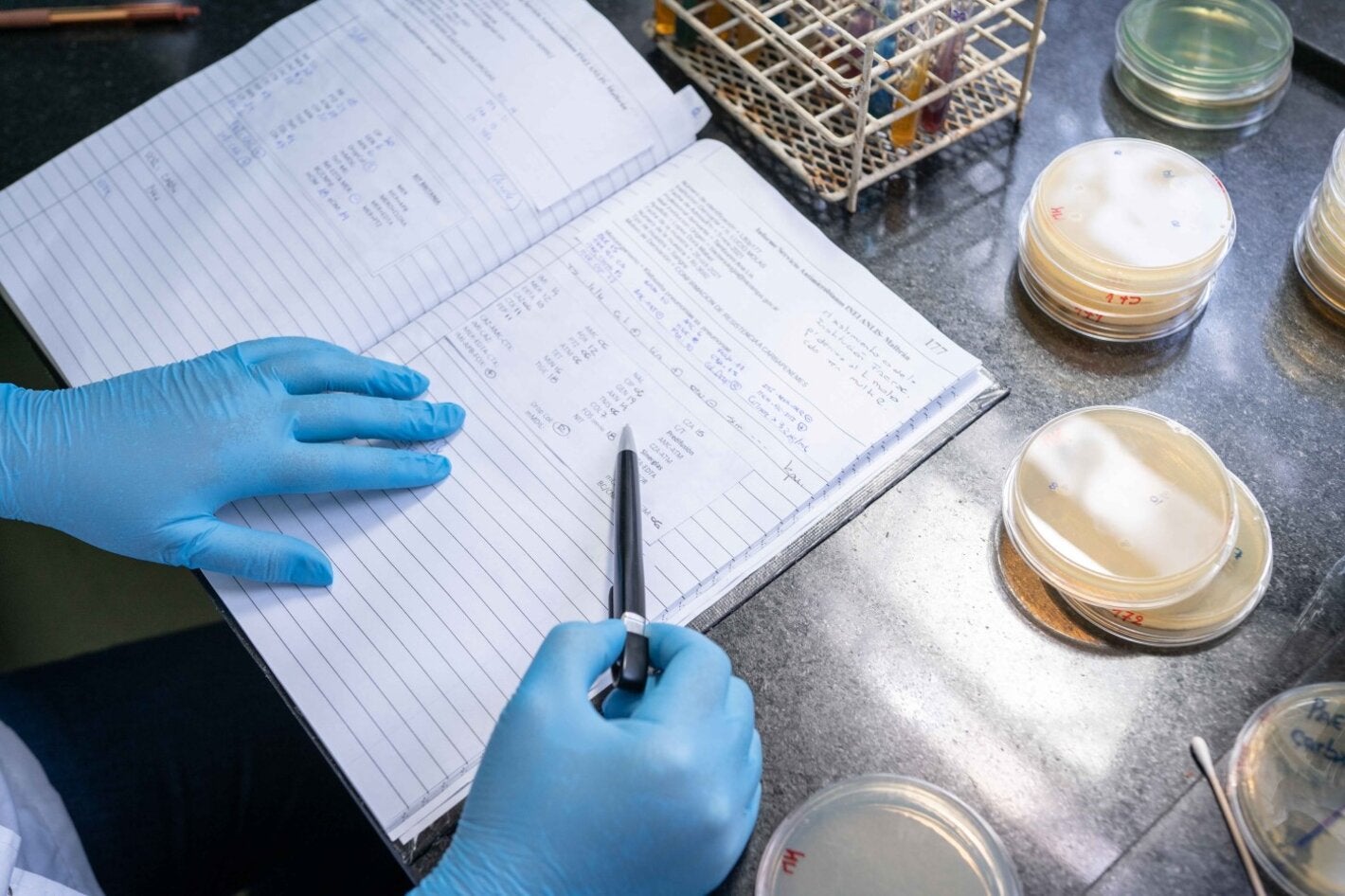 Registros de los resultados de las pruebas de identificación microbiana y sensibilidad antibiótica.