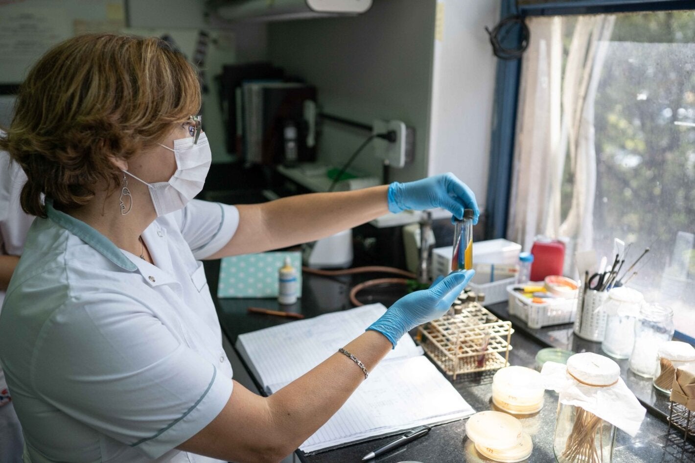 Pruebas para identificación bioquímica de microorganismos para el diagnóstico referencial.