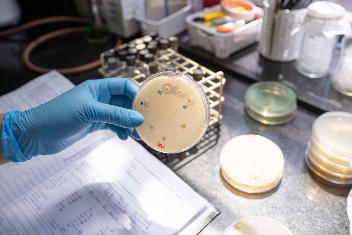 Cultivo bacteriano al que se le probaron diferentes antibióticos.