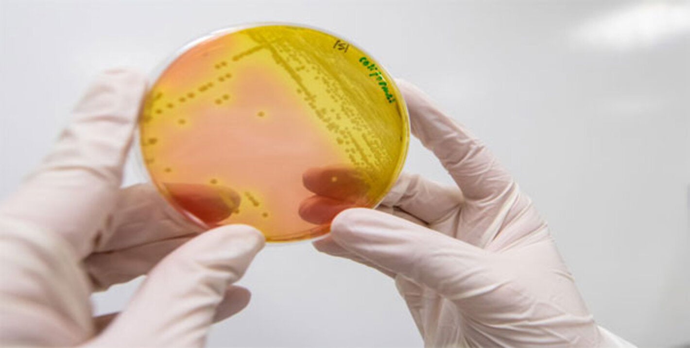 foto de bacteria en un  recipiente