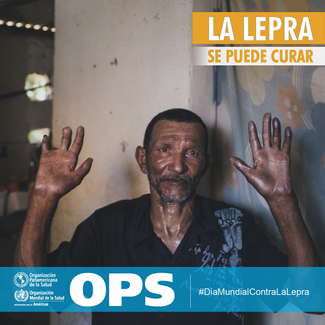Día Mundial contra la Lepra 2019-Postal para redes sociales
