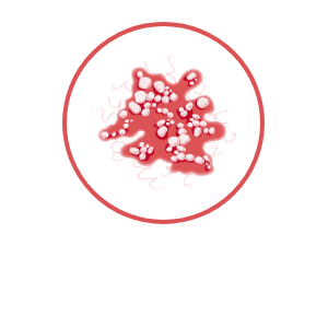 herpes genital