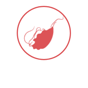 tricomoniasis
