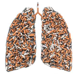 Smokers lung 