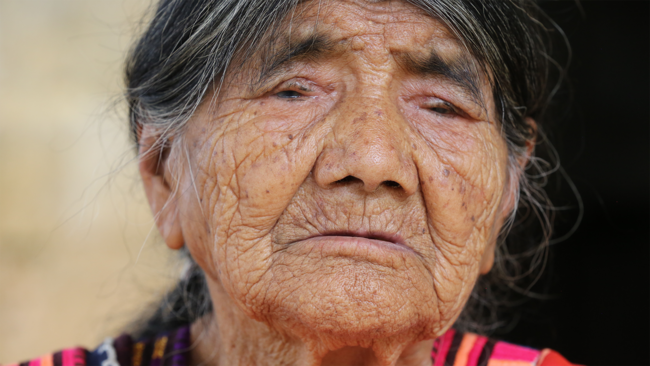 Old women with trachoma