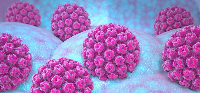 Que es el papilomavirus humano kaiser permanente marietta