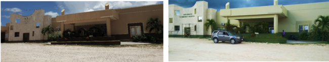 Before and after view of the San Ignacio Community Hospital in Belize