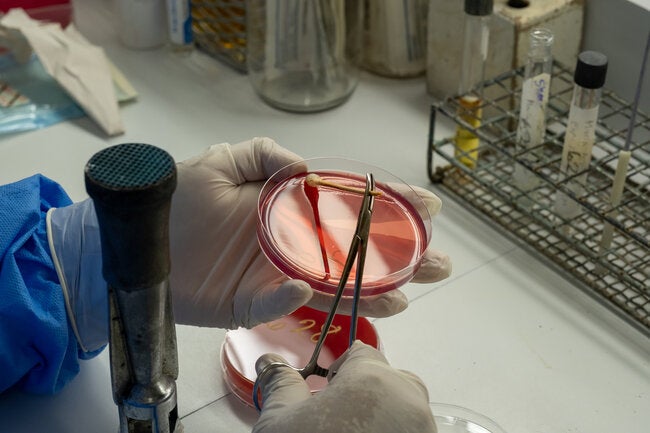 Resistencia Antimicrobiana