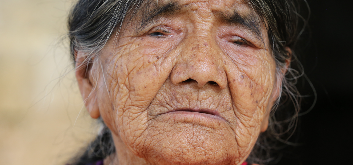 With new eyes - Trachoma elimination in Mexico