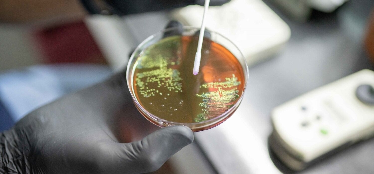 Bacterial culture to be identified and tested for antimicrobial susceptibility