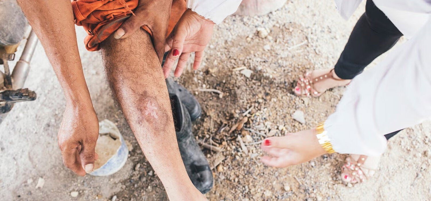 Historia de éxito: Primeras victorias contra la Leishmaniasis