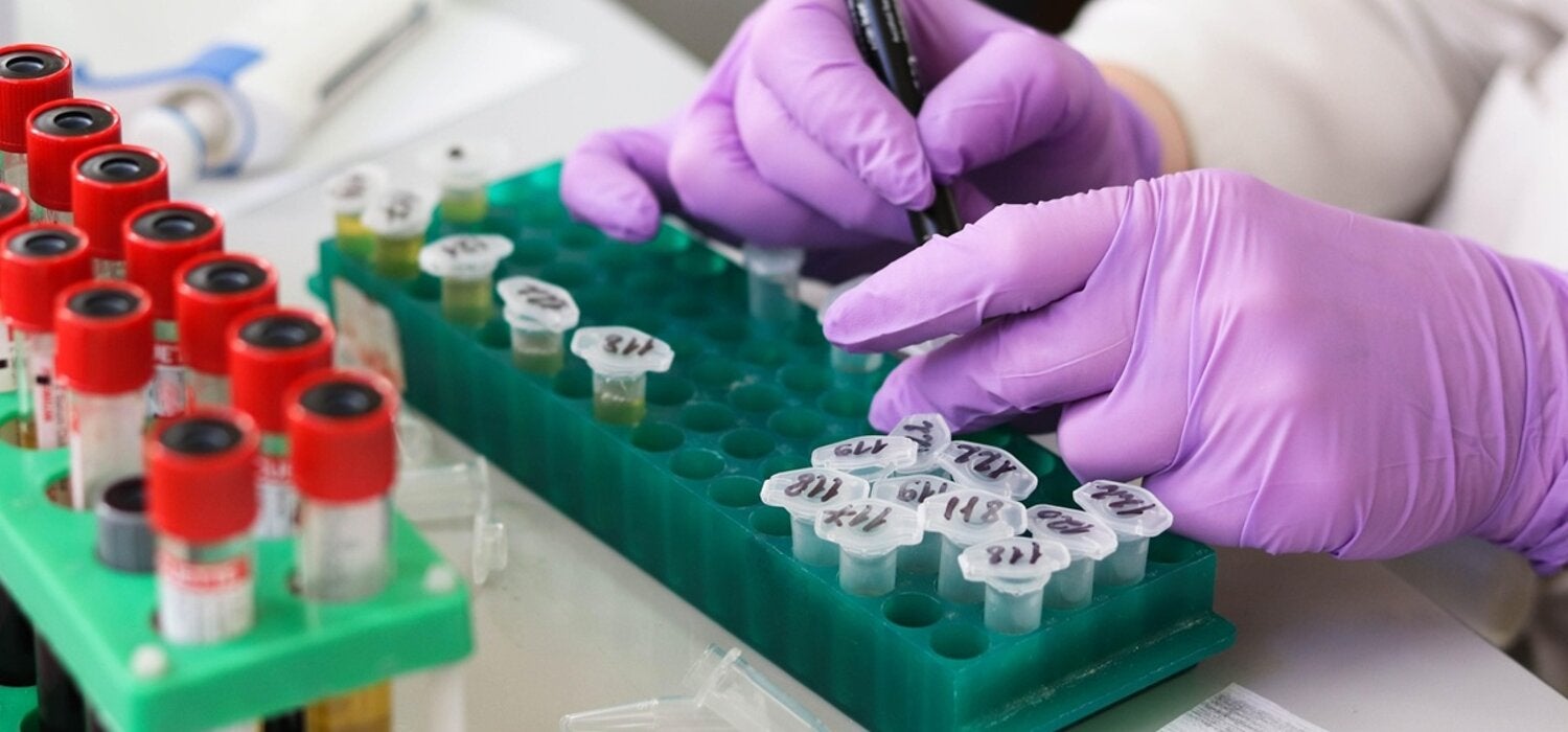 laboratory technician hands.