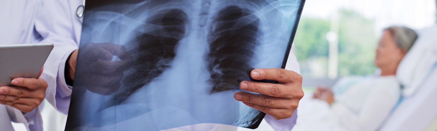 Doctors reading X-Ray with patient in background