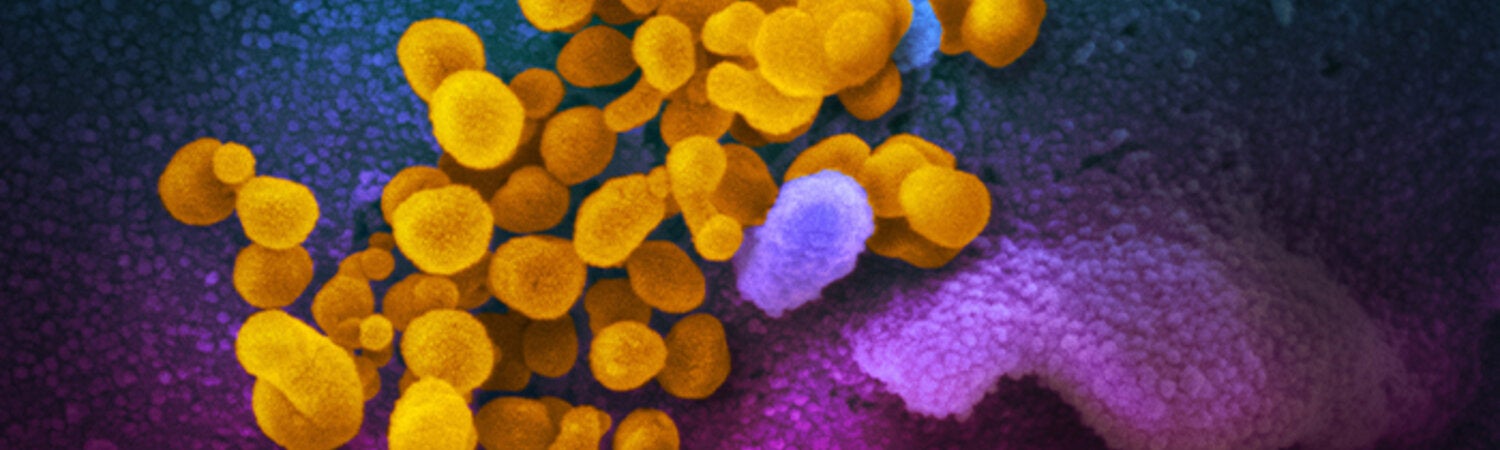 covid-19 en el microscópio