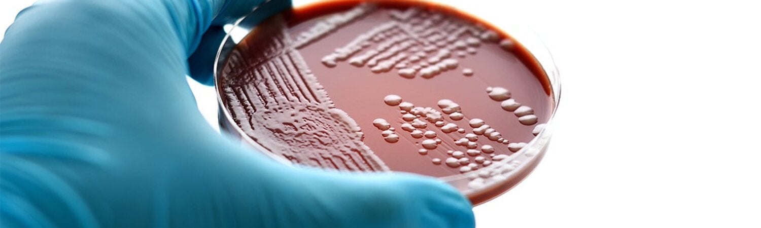 lab gonorrhea petri dish