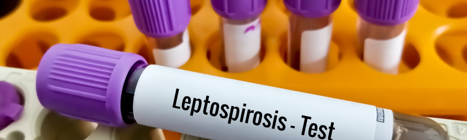 Leptospirosis test