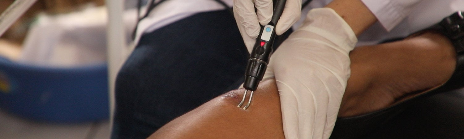 Leishmaniasis