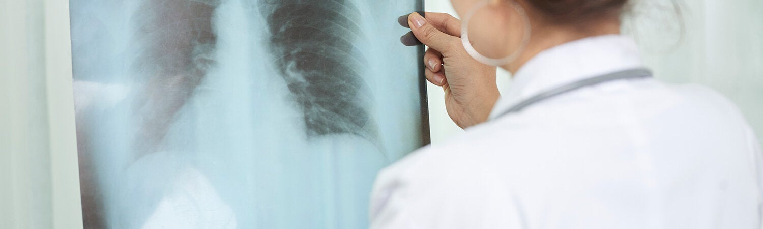 doctor studying chest x-ray